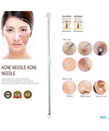YNR Needle Acne Blackhead Remover Pimple Extractor Round Tool Pimple Spot Removal Tool Used to Remove Facial Blackheads and Pimples - Buy Online on GoSupps.com