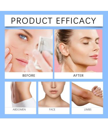 mother Scar ointment after op scar ointment for old scars versatile scar cream for surgical scars caesarean section acne scars burns keloids 30 g - Buy Online on GoSupps.com