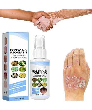 Herbal Psoriasis Relief Spray Eczema Relief Spray Vitiligo Psoriasis Treatment Relief Spray Skin Repair Spray Body Moisturizer Spray for Itchy Skin Relief (3 Pcs)