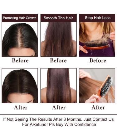 Rosemary Oil Hair Growth Serum & Shampoo - Biotin & Argan for Thinning Hair Perfect Christmas Gifts for Women Moms & Wives - Buy Online on GoSupps.com
