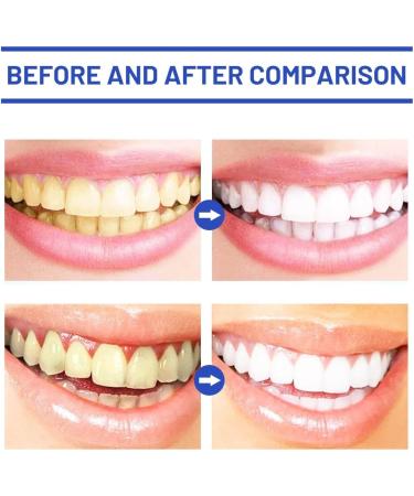 3 Days Teeth Whitening Powder Teeth Whitening Powder for White Teeth | Teeth Whitening | Visible Cleaning Effect | Safe Teeth Whitener - Cosmetic Teeth Cleaning (3) - Buy Online on GoSupps.com