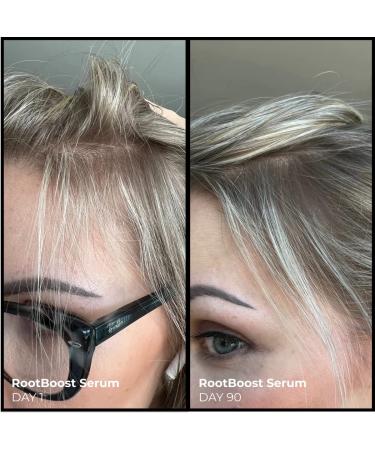 EVOLVh Better Roots RootBoost Serum - Natural Scalp Wellness + Hair Regrowth | Vegan, Non-Toxic, Clean Hair Care (1 fl oz | 30 ml) - Buy Online on GoSupps.com