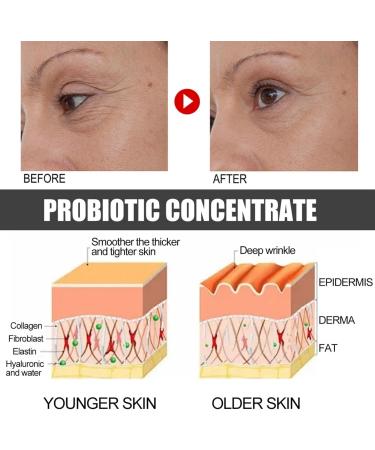 Caffeine Solution 5% + Egcg Caffeine Eye Cream For Wrinkles Caffeine & Hyaluronic Acid Under Eye Serum Caffeine Eye Serum Anti Aging Under Eye Cream For Reduce Circles And Puffy Eyes Eye Bag Removal - Buy Online on GoSupps.com