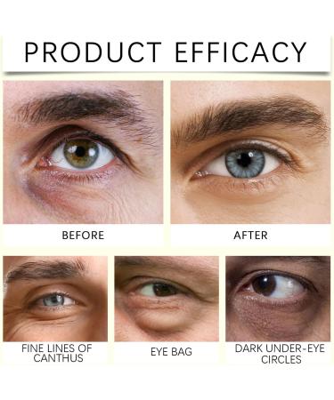 QPJUVC Retinol Firming Eye Cream against wrinkles and fine lines antiaging treatment for the eyes with Retinal Shot Tightening Booster for hydration and firming 4 - Buy Online on GoSupps.com