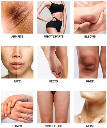 Brightening Underarm Cream 60ml - Moisturizing Formula for Neck, Knees & Private Parts - Intimate Skin Moisturizer - Buy Online on GoSupps.com