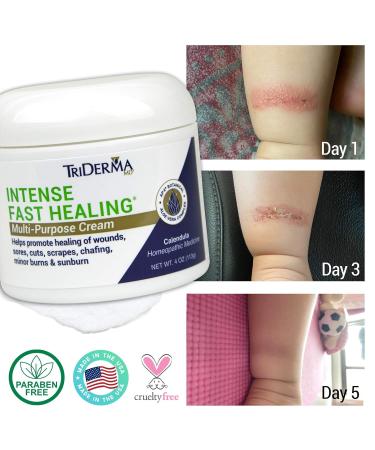 TriDerma Intense Fast Healing Cream - 4 Ounces | Accelerates Healing for Minor Skin Irritations, Rashes, Scrapes, Cuts - Buy Online on GoSupps.com