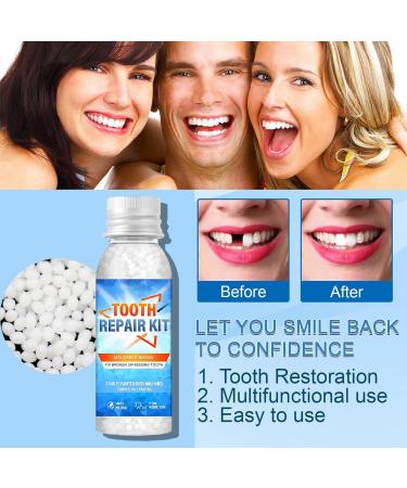 Temporary Tooth Filling Repair Kit with Professional Tools - Tooth Repair Granules for Missing Teeth | Tooth Replacement & Repair - Buy Online on GoSupps.com