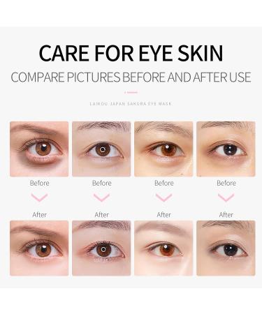 Eye Mask JAPAN SAKURA - 100pcs Nourishing Eye Patches for Puffy Eyes Dark Circles & Under Eye Bags - Buy Online on GoSupps.com