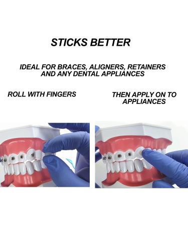 Genuine Orthowax - Superior Orthodontic Wax for Braces - Best Adhesion Guaranteed - Buy Online on GoSupps.com