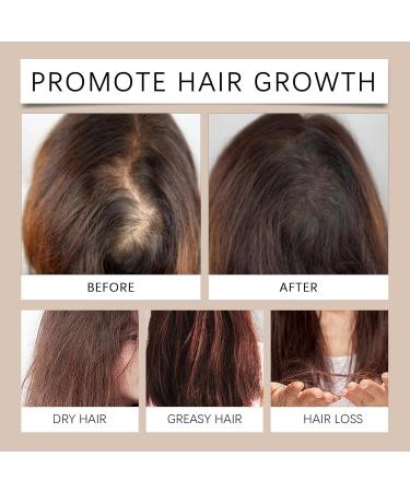 Batana Growth Oil 3 Pack Moisturizing and Restorative Hair Growth Oil - Buy Online on GoSupps.com