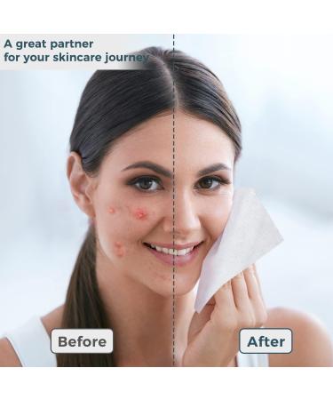 Biodegradable Disposable Face Towels - Lint-Free Makeup Remover for Sensitive Skin | Ourmed Life - 60 Pieces - Buy Online on GoSupps.com
