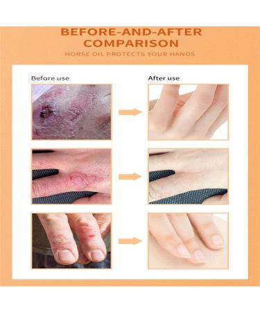 Anti-freeze Hand Cream with Horse Oil Camel Milk and Avocado for Cracked Hands Long-lasting Moisturizing Lifting Care Making Your Hands Smooth and Soft - Buy Online on GoSupps.com