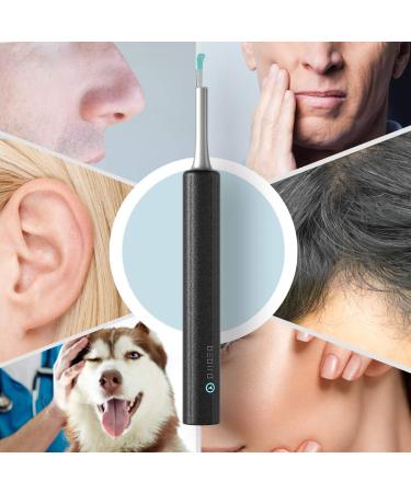 Ear Wax Removal Tool with 1080P Camera - Otoscope Kit for iPhone & Android Phones - Buy Online on GoSupps.com