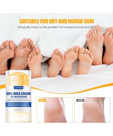 Wvu Wvo Moisturizing and anticracking foot cream moisturizing and anticracking foot cream foot care cream relieves extreme dryness and cracking of the feet - Buy Online on GoSupps.com