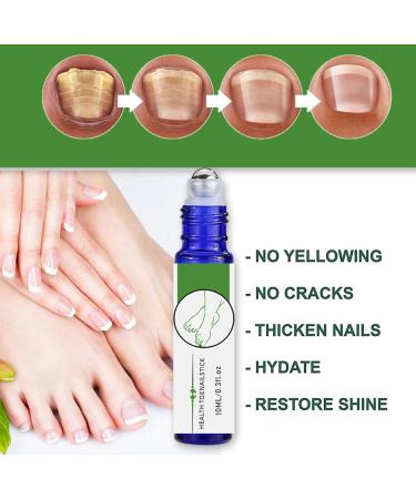  Esncddym Cracked Toenail Repair Roll On Cuticle Oil Health Toenail Stick Roller 0.3 ml Natural Soothing Softening Nail Repair Deep Penetration Nourish For Foot & Hand Care - Buy Online on GoSupps.com
