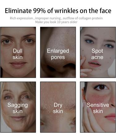 Face Moisturizer Face Cream Skin Care Beauty with Niacinamide & Retinol Removes Acne Redness Fade Dark Spots (100g) - Buy Online on GoSupps.com