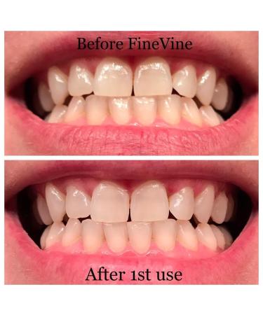 Organic Vegan Coconut Charcoal Toothpaste for Healthy Gums & Pearly Whites - Made in USA - Buy Online on GoSupps.com