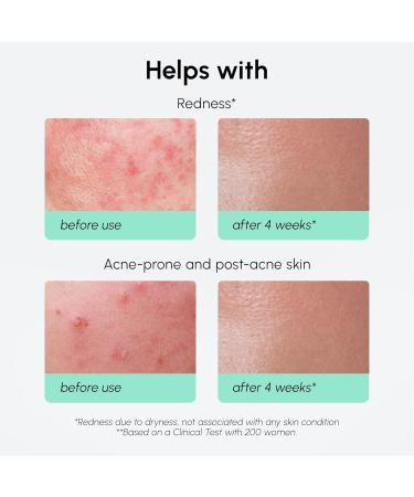 MAREE 10% Azelaic Acid Face Serum - Redness Soothing Hydrating Serum with Niacinamide Centella Asiatica & Hyaluronic Acid - Relief Serums for Face & Body - Azalecic Acid Skin Facial - Acido Azelaico 1 Fl Oz (Pack of 1) Aze  - Buy Online on GoSupps.com