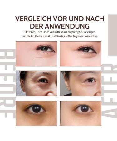 Caffeine Solution Caffeine Eye Serum Eye Cream for Dark Circles and Puffy Eyes Eye Cream for Anti-Aging Wrinkles - Buy Online on GoSupps.com