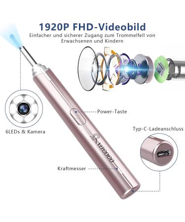 Vitcoco 1920p WiFi Otoscope - IP67 Waterproof Ear Wax Removal Camera for Adults Children & Pets - 360 Wide Angle 6 LED - Pink - Buy Online on GoSupps.com