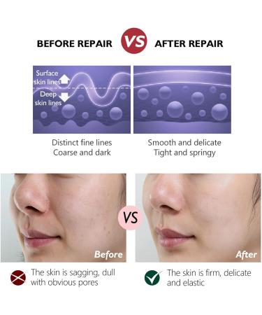 Retinol Cream - Face Cream Anti-Aging Wrinkle Night/Day Cream With 2.5% Retinol - Eye Face Moisturiser to Help Skin Regenerating Reduce Wrinkles Fine Lines Dry Skin Age Spots 30ml Retinol Face Cream - Buy Online on GoSupps.com