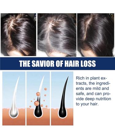 Kanoauo Hair Growth Cream 20 g regrowth cream strengthens the roots promotes scalp health and restores hair growth accelerates hair growth - Buy Online on GoSupps.com