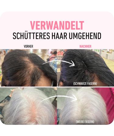 Boldify Scatter Hair Powder for Thinning Hair - Dark Chestnut Brown (56g) - Hides Hair Loss in 15 Sec - Ideal for Men & Women - Large Bottle - Buy Online on GoSupps.com