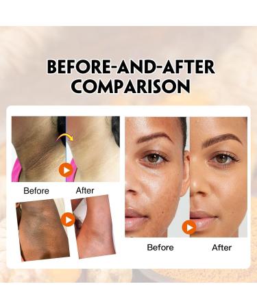 Turmeric Body Scrub - Dark Spot Exfoliating Body Scrub for Face & Neck Armpit Foot Butt Back - Moisturizing Body Exfoliator Scrub & Acne Blackhead Remover - Natural Body Skin Care Scrub - Buy Online on GoSupps.com