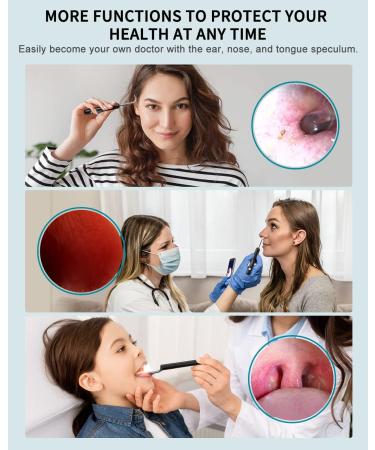 XKOO Ear Wax Removal Kit - 1080P FHD Otoscope & 6 LED Lights - Wireless Ear Camera - 8pcs Accessories - Multifunctional Black - Buy Online on GoSupps.com