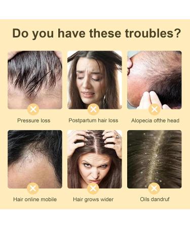 Bisienya Ginger Plant Extract Anti-Hair Loss Hair Shampoo Ginger Extract Shampoo Plant Extract Oil Control Anti-Dandruff Shampoo for Hair Growth Ginger Anti Hair Loss Shampoo for Women & Men - Buy Online on GoSupps.com