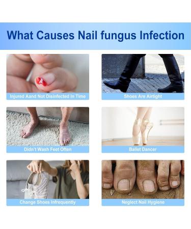 Nail Repair Plaster Nail Repair Kit For Broken Natural Nails Extra Strength Treatments For Damaged Nails Non-irritating Breathable Toenail Correction Treatments - Buy Online on GoSupps.com