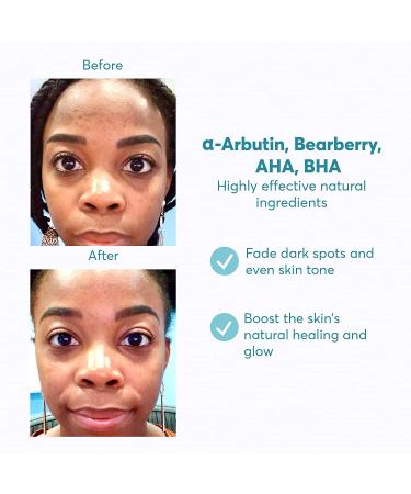 MDacne Dark Spot Remover for Face & Body 2oz - Brightens Skin Oil-Free for Sensitive & Acne-Prone Skin AHA & BHA Formula Dermatologist Approved - Buy Online on GoSupps.com