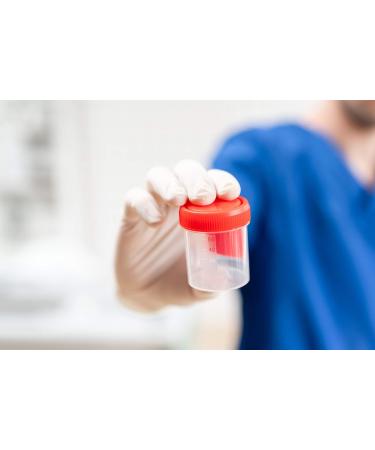 Buy Alcohol Test Strips - Urine Test Kit (3 Tests) | Fast International Shipping - Buy Online on GoSupps.com