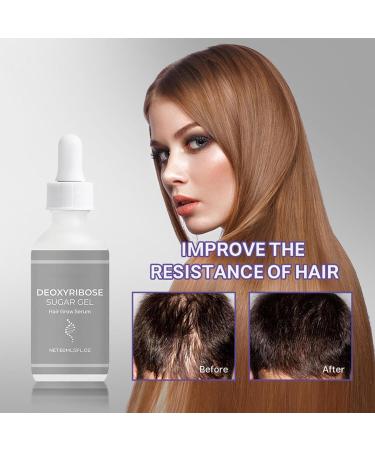  G n rique Hair Growth Oil Hair Strengthening Oil Nourishing Scalp Moisturizer Non-Greasy Strengthens Roots Reduces Breakage for Women Men Daily Use Lightweight 60 ml - Buy Online on GoSupps.com
