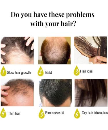 Thicken Strengthen Longer Hair hair care spray hair product - Buy Online on GoSupps.com