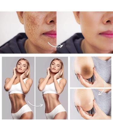 Intimate Area Dark Spot Corrector - Underarm, Knees, Elbows, Thighs, Private Parts Cream - Buy Online on GoSupps.com