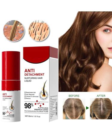 Hair spray anti-fall nourishing hair spray hair and beard hair growth liquid improve scalp and hair deep conditioning and moisturizing suitable for all hair types 1pcs - Buy Online on GoSupps.com