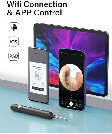 Smart Ear Wax Removal Tool with 1080p Camera - Rechargeable & Wireless - Compatible with iPhone, iPad, Android - Ear Cleaning Kit by Bebird - Buy Online on GoSupps.com