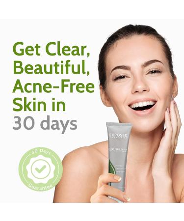 Exposed Skin Care Clear Pore Serum - Fast-Acting Acne Treatment with Salicylic Acid, Green Tea & Licorice Root for Clear, Tightened Pores - Buy Online on GoSupps.com