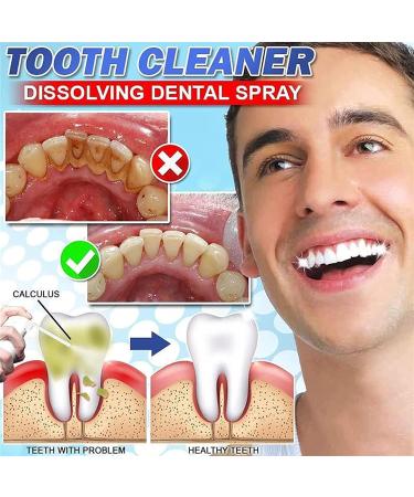 Intensive Stain Removal Toothpaste & Dental Spray Set - Lime Free Tooth Cleaner | 3 Piece Kit for Easy Oral Care - Buy Online on GoSupps.com