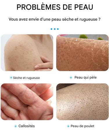  YNPQTDS Foot Repair Cream | 100g Soothing Ointment - Cream for Cracked Heels | Quickly Softens Hard Skin Prevents Recurring Dryness for Feet - Buy Online on GoSupps.com