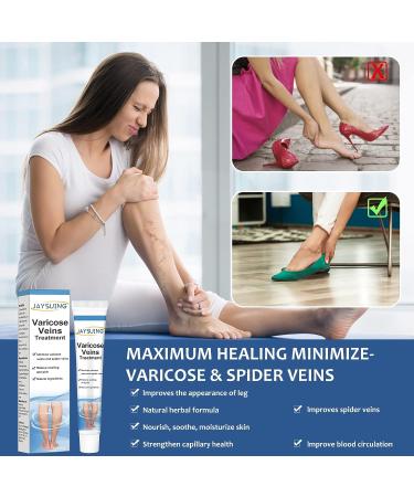 TASVAM Varicose Veins Cream - Treatment for Legs, Relief Spider Veins, Strengthen Capillaries for Improved Circulation - Buy Online on GoSupps.com