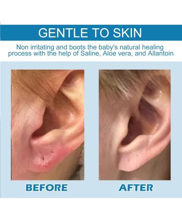 KOAHDE Anti Cochlear Blockage Removal Spray Ear Nose Piercings Cleaning Spray Ears Earwax Removal Spray Ear Wax Softener Cleaner Natural Ear Spray for Cochlear Blockage Safe & Effective 30ML - Buy Online on GoSupps.com