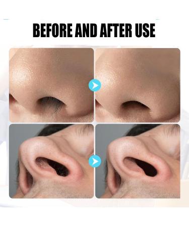 2024 Upgraded 2-in-1 Nasal Hair Cutter & Nostril Hair Remover Tool - Double Sided Nose Hair Trimmer for Men & Women | 360 Rotating Design | 3 Set - Buy Online on GoSupps.com