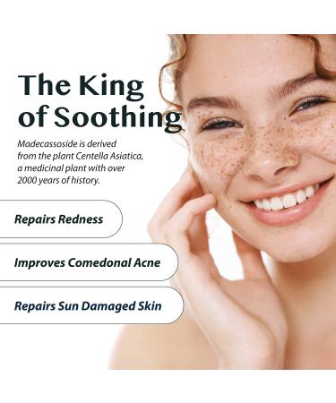 A'PIEU Madecassoside 2X Cream 1.69 fl oz - For Combination & Blemish-Prone Skin, Soothes Dryness, Sun Damage, Dark Spots - Centella Asiatica Formula - 1.69 Fl Oz - Buy Online on GoSupps.com