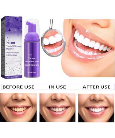 50ml Teeth Whitening Mousse - Stain Removal Breath Freshener & Color Corrector Foam for Perfect Smiles - Buy Online on GoSupps.com