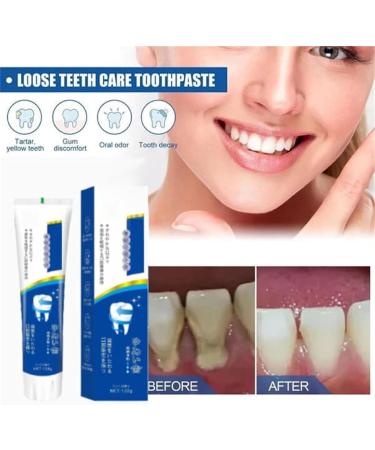 Consentbil Repair Probiotic Toothpaste Whitening Toothpaste Repairs and Protects Whitening Toothpaste Removes Tooth Stains Fresh Breath - Buy Online on GoSupps.com