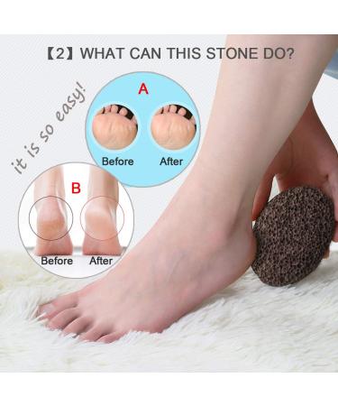 Volcanic Lava Pumice Stone - Natural Foot Callus Remover - Buy Online on GoSupps.com