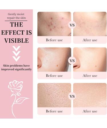 Rose Hyaluronic Acid Face Moisturizer for Women - Moisturiser Face Women - Anti Aging Face Cream - Face Cream with Rose Extract and Hyaluronic Acid - Skin Lightening Cream with Light Texture - Buy Online on GoSupps.com