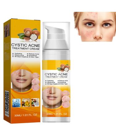 KOAHDE Facial Anti Acne Essence Acne Essence Anti Acne Hydrating Essence Anti Acne Facial Serum Acne Treatment Serum Serum Skin Smoother Acne Removing Moisturizing Serum Skin Rejuvenation Serum